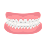 Orthodontics.