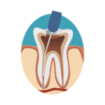 Endodontics.