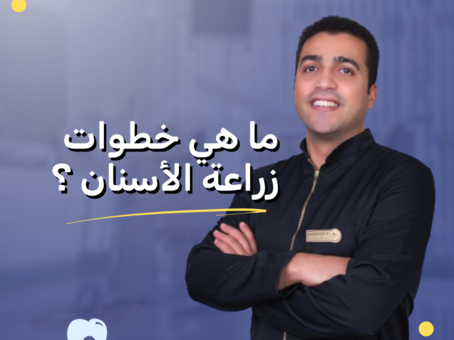 اعرف اكتر عن خطوات زراعة الاسنان من افضل خبراء زراعة الاسنان الدكتور احمد خيري.